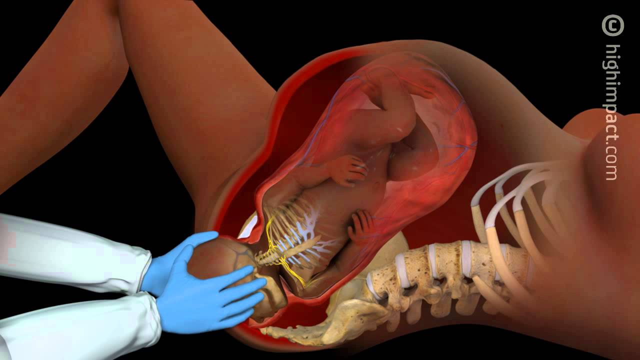 Brachial Plexus Injury