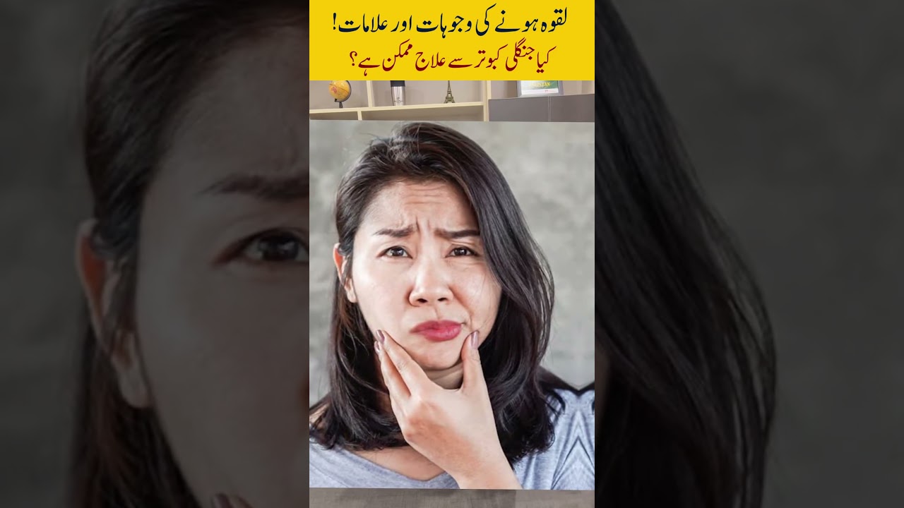 Bell&rsquo;s palsy-laqwa ka ilaj |Facial paralysis causes & treatment #bellspalsy  #doctor #shortvideo