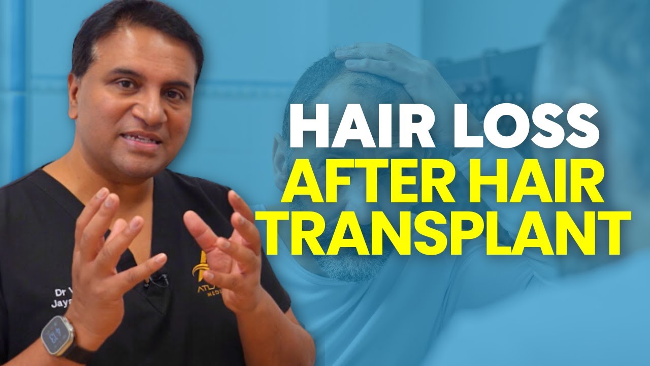 Shock Loss After a Hair Transplant?
