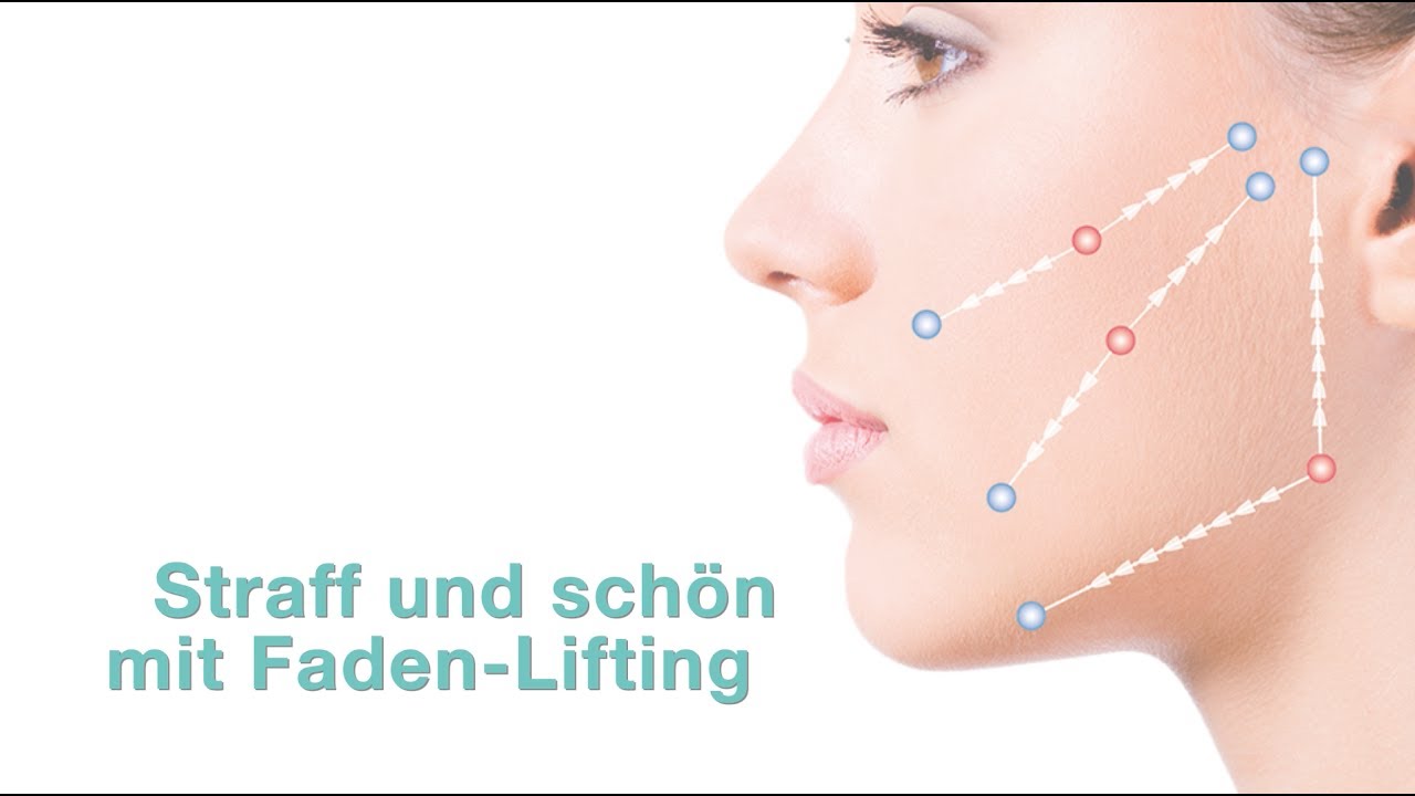 Fadenlifting: Wie funktioniert es und was kann ich erwarten?