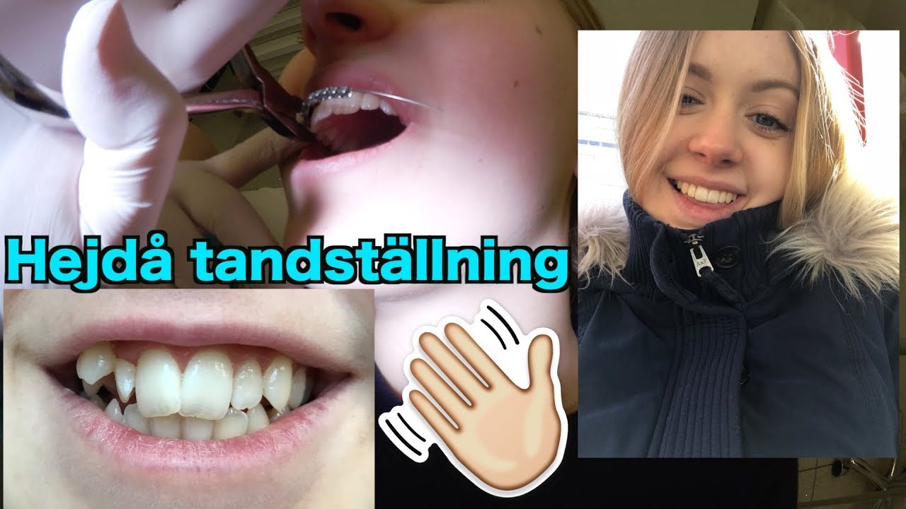 TAR UT MIN TANDSTÄLLNING!