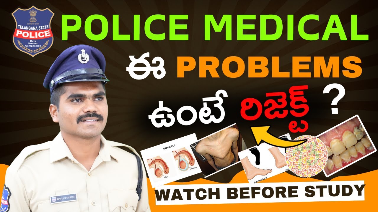 🎯TG SI/CONSTABLE Medical Test😱| ఈ Problems ఉంటే రిజెక్ట్?😰| #police #tsconstable #policemedical