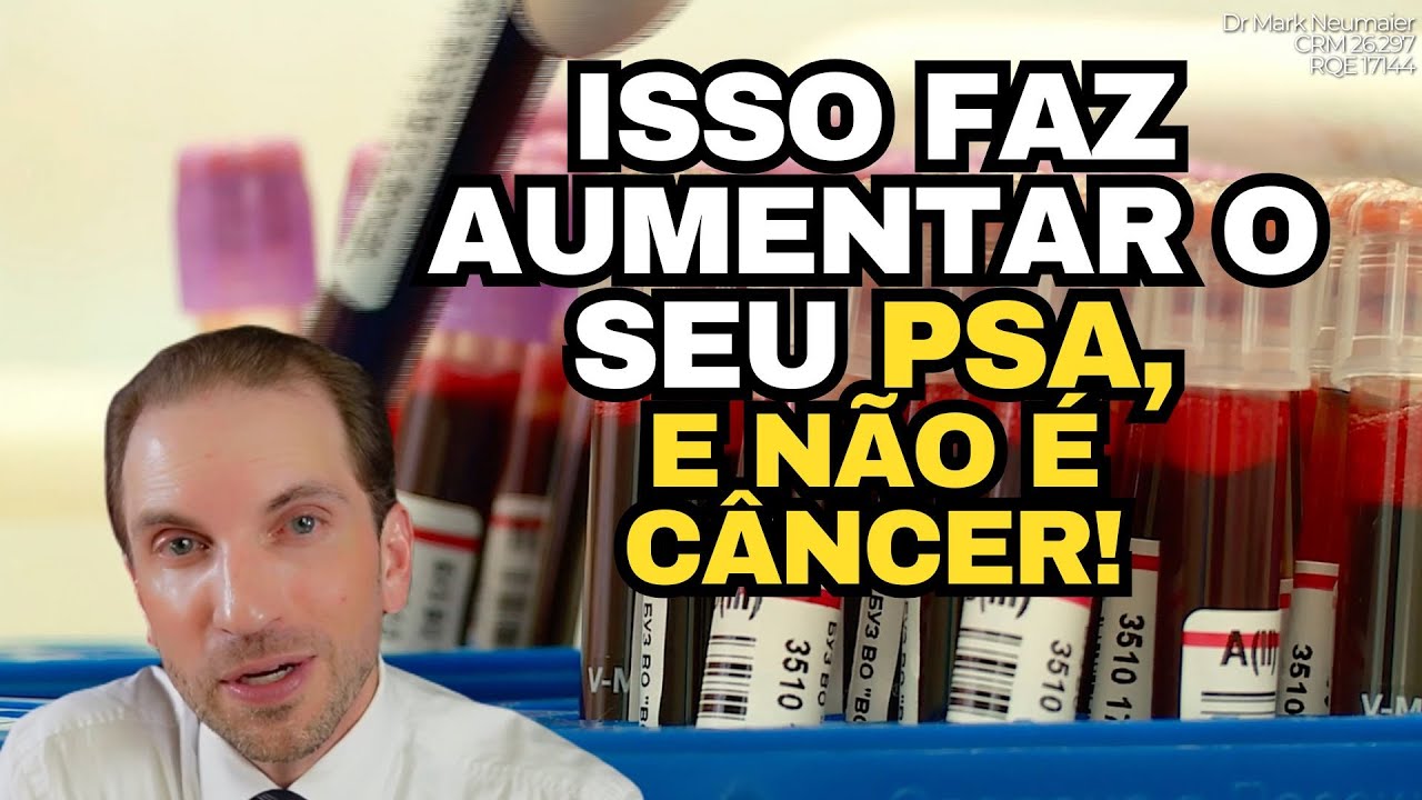 Quem tem ISSO PODE TER O PSA MAIOR (E NEM IMAGINA!)