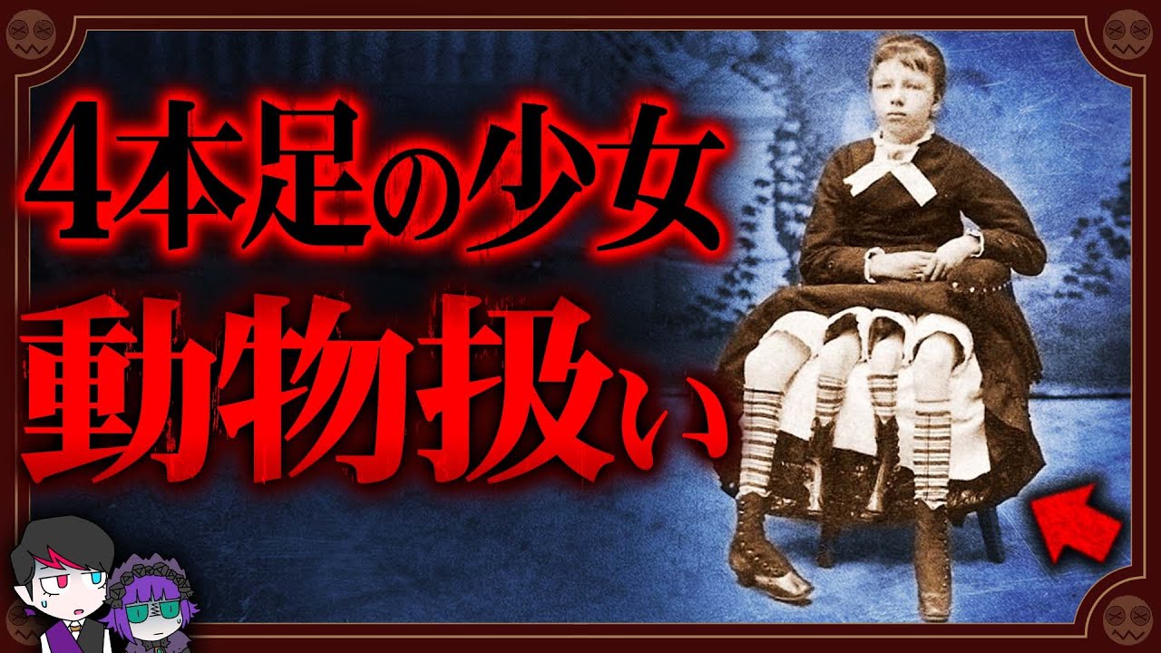 病気の少女を動物扱い…４本足の少女「マートル・コービン」