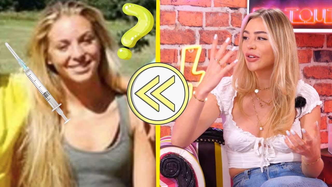 Kellyn #LPDLA8 Compl&egrave;tement refaite ? R&eacute;v&eacute;lation sur ses l&egrave;vres et d&eacute;tail de ses chirurgies !