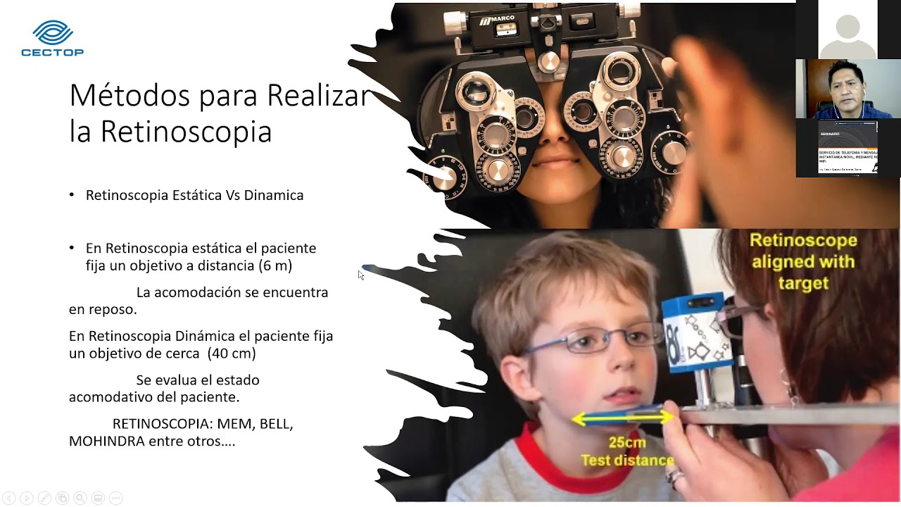 Taller Basico de Retinoscopia