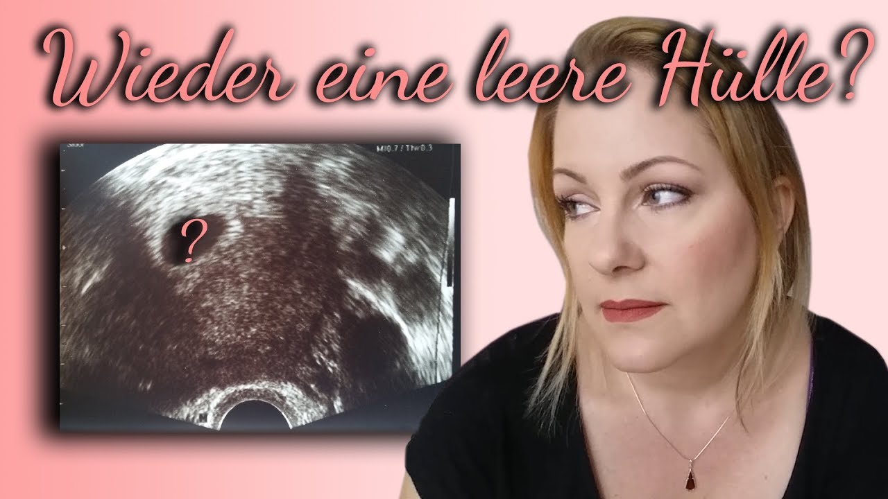 1. ULTRASCHALL - MEIN ALPTRAUM WIRD WAHR  - 2. Ultraschall und der Schock ist groß !