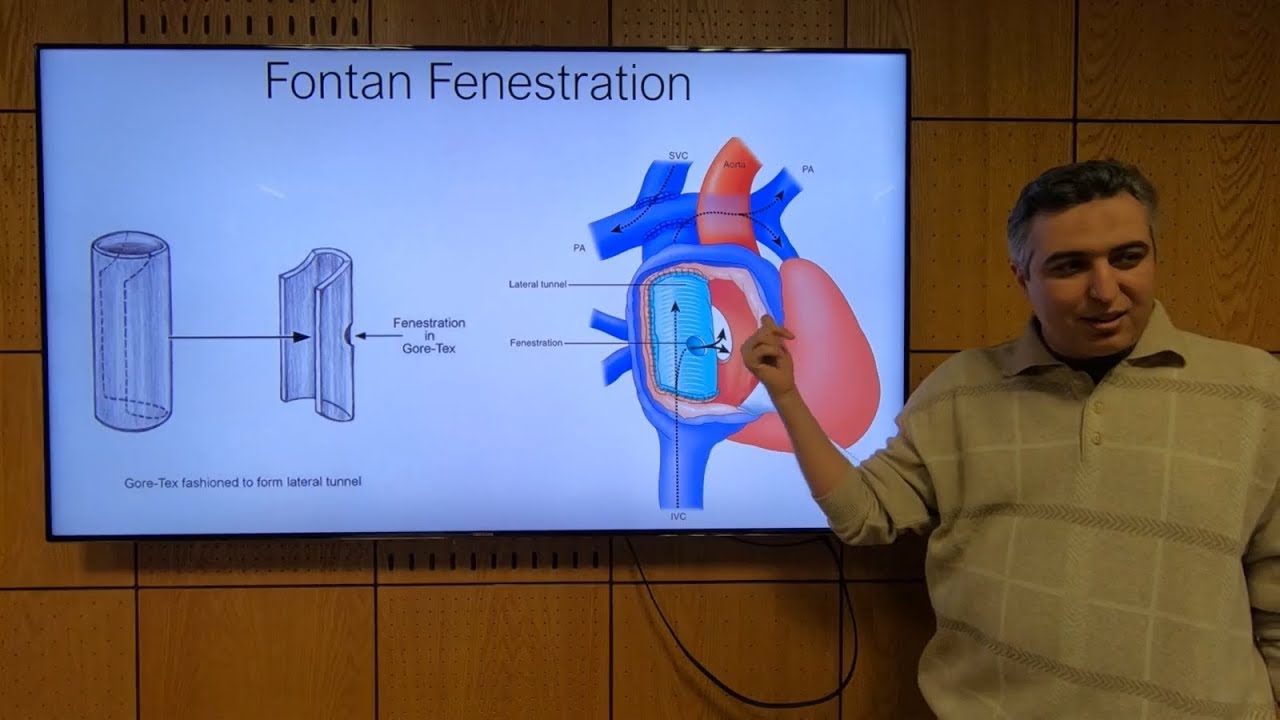 Single Ventricle (Part 2) - Hatem Hosny