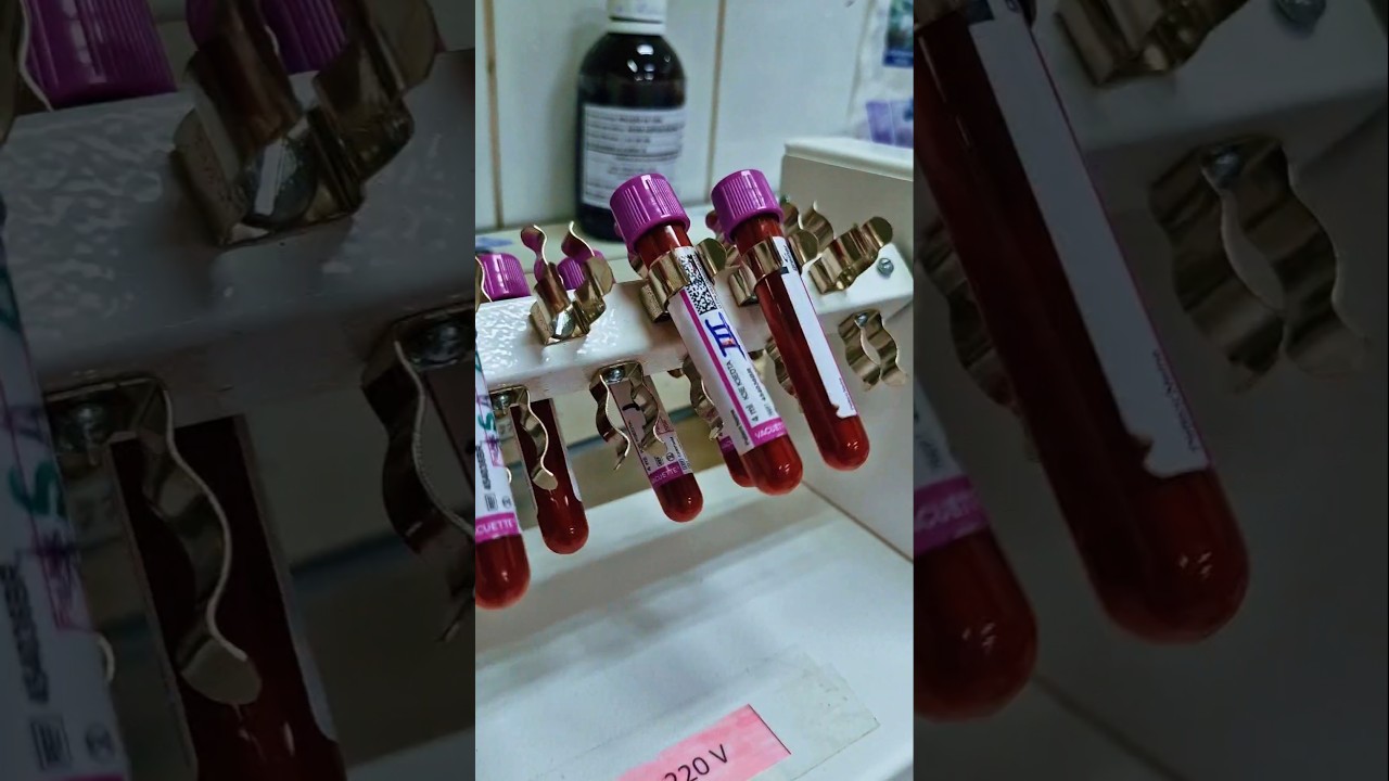 Hematologia🩸 - Est&aacute;gio em An&aacute;lises Cl&iacute;nicas