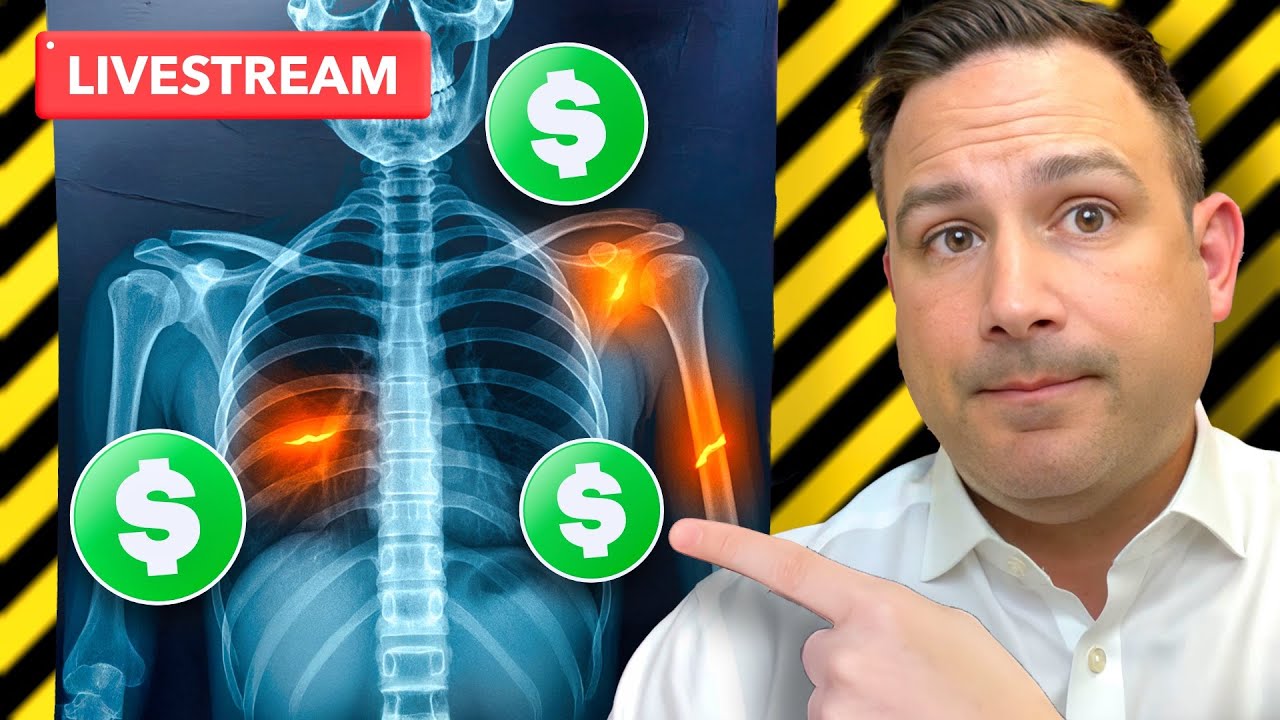 The Secret To MAXIMIZING Your Benefits in Multiple Injury Claims!