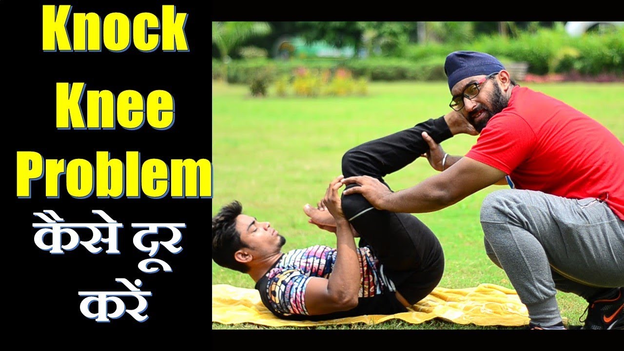 KNOCK KNEE PROBLEM | How to Fix  IN HINDI | FITNESS FIGHTERS