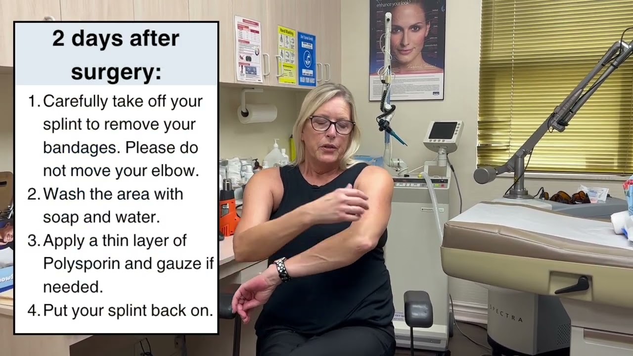 Cubital Tunnel Surgery Recovery: Expert Advice from Kim Tait & Dr. Colin Hong