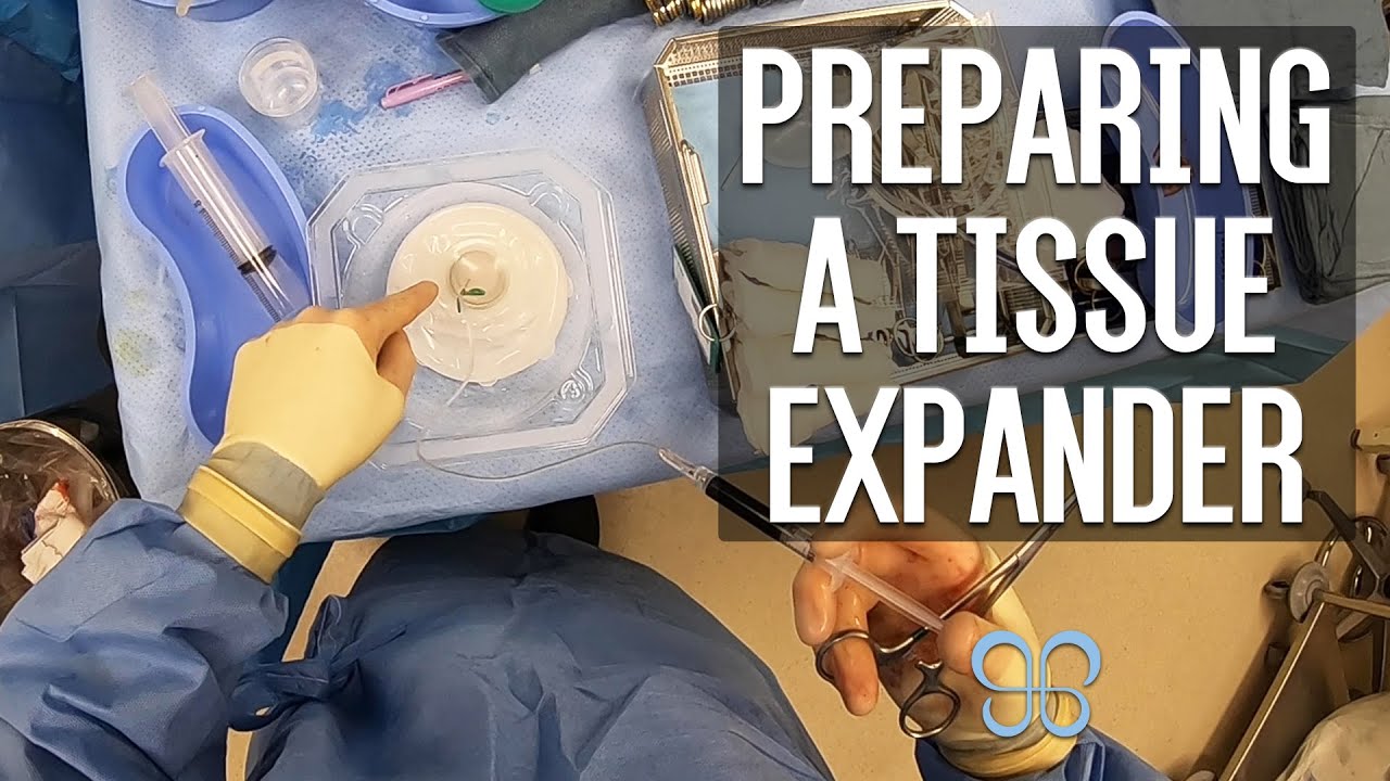 Surgeon POV of Preparing a Tissue Expander | Brown Plastic Surgery