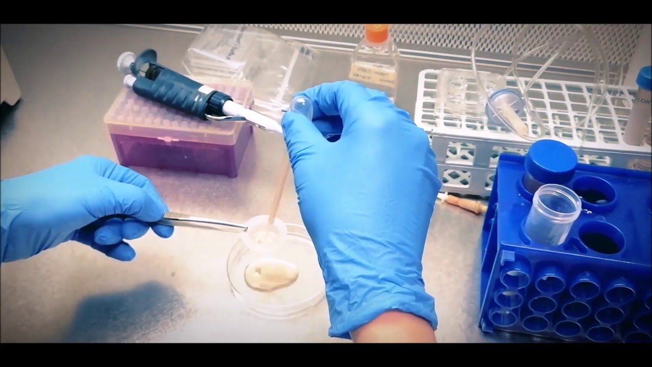 İneklerde oosit toplama (collecting cow oocytes)