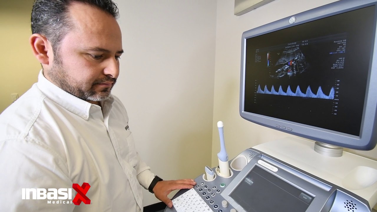 ULTRASONIDO VOLUSON E6 GE HEALTHCARE