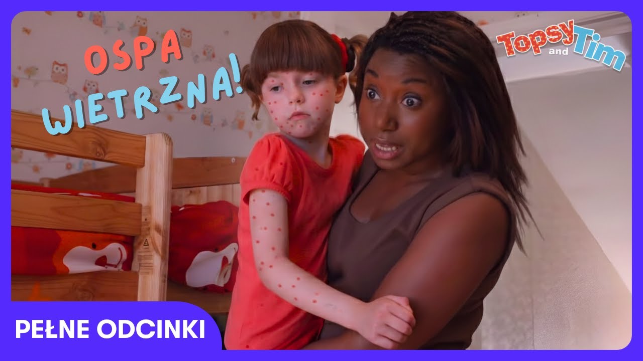 Topsy and Tim - Ospa wietrzna u dzieci! | TV Dzieci | WildBrain Dom Zabaw