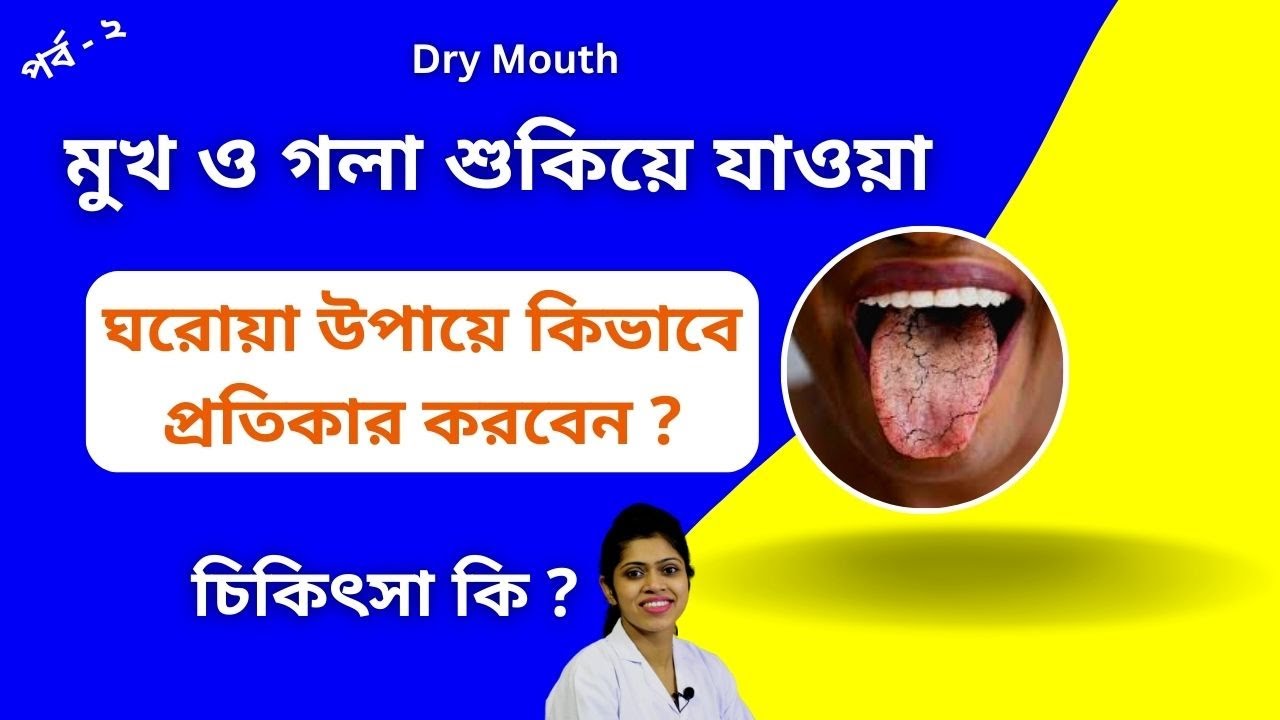 মুখের ভেতর শুকিয়ে গেলে ঘরোয়া উপায়ে কিভাবে প্রতিকার করবেন ?🔥 🔥  মুখ শুকিয়ে গেলে চিকিৎসা কি ?