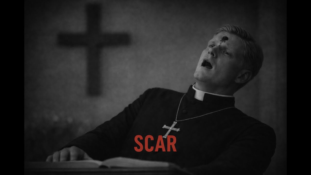Scar — A Side Story.