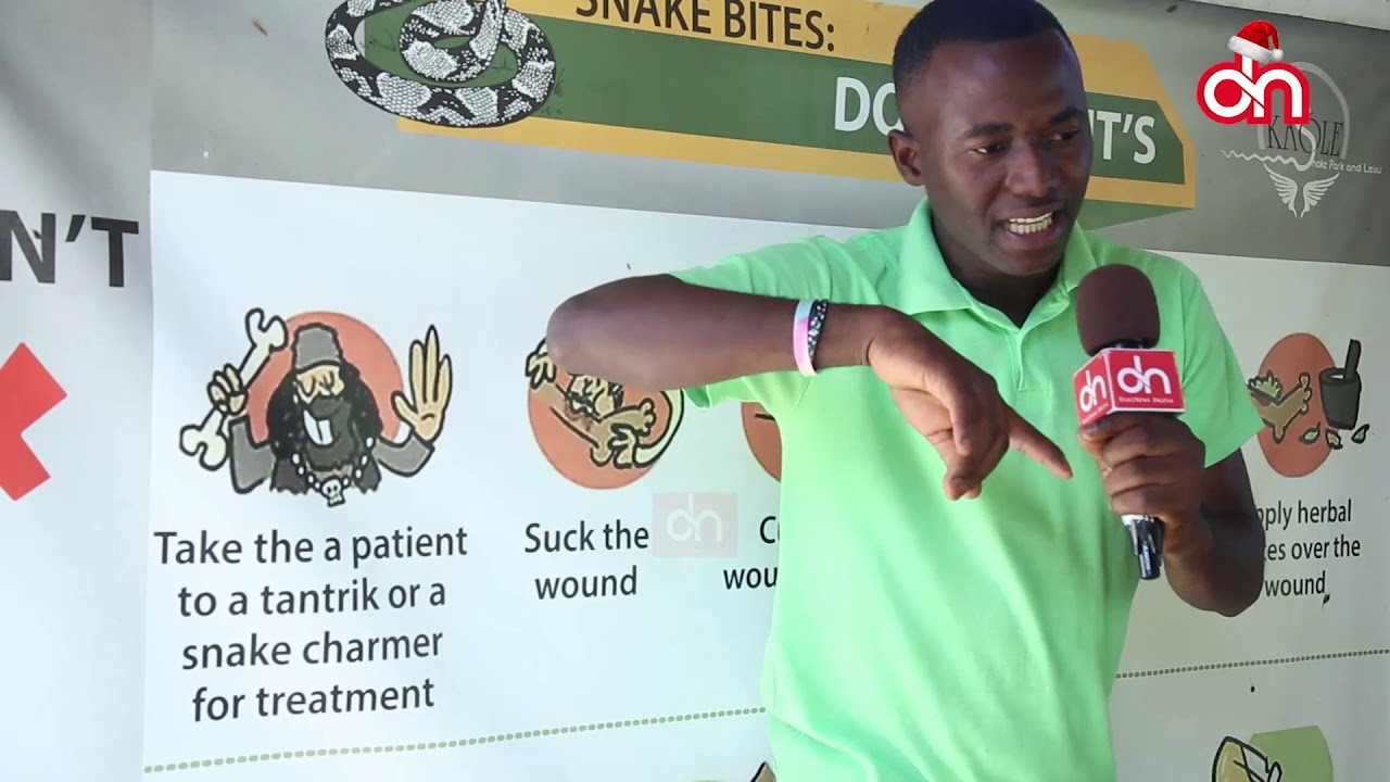 Mambo ya kuzingatia unapoumwa na nyoka mwenye sumu