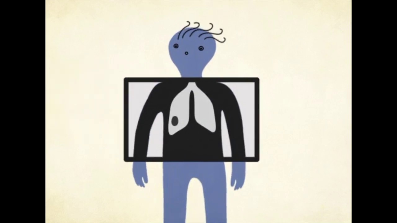 Animerad film om cancer (film3) Hitta r&auml;tt behandling