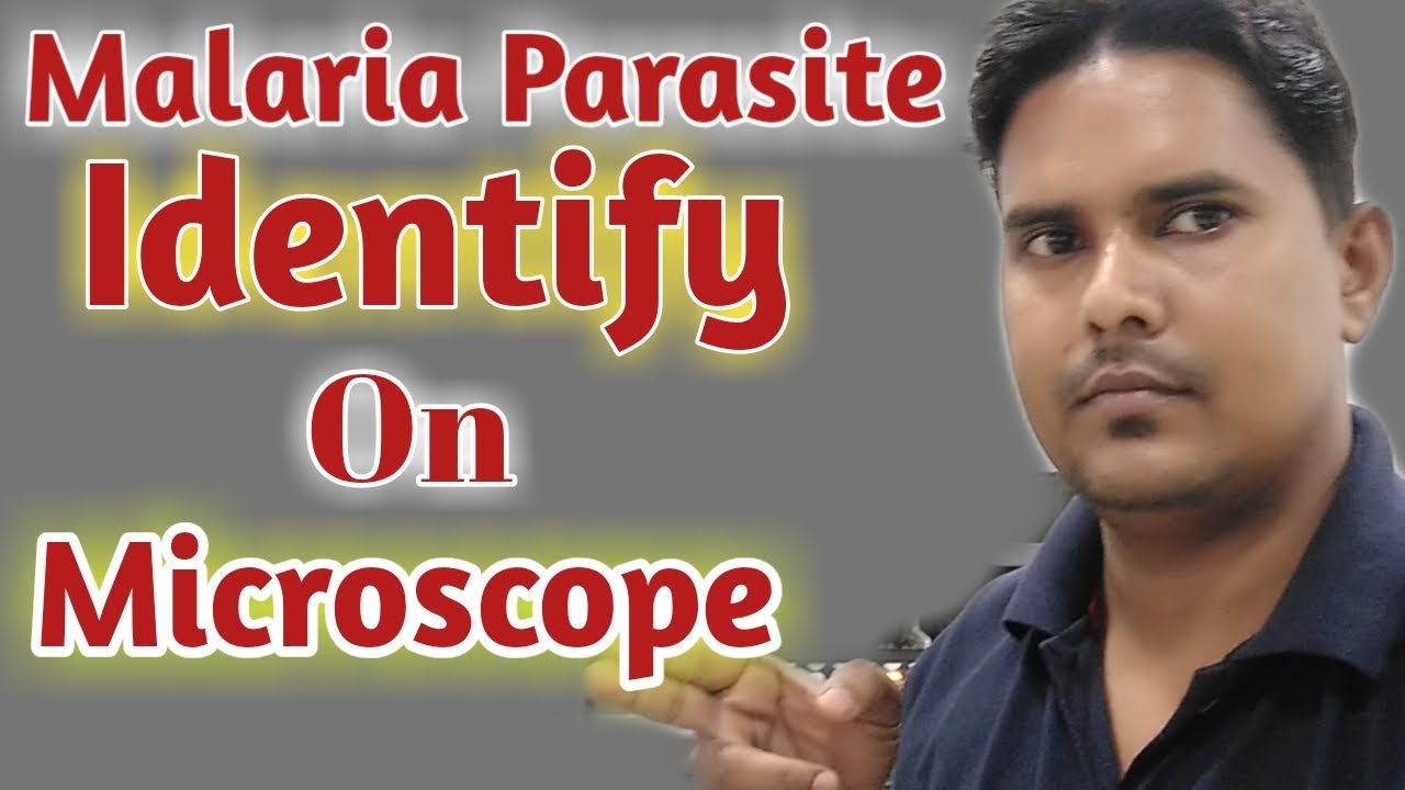 Malaria parasite under microscope | Malaria parasite procedure | P vivax malaria in hindi