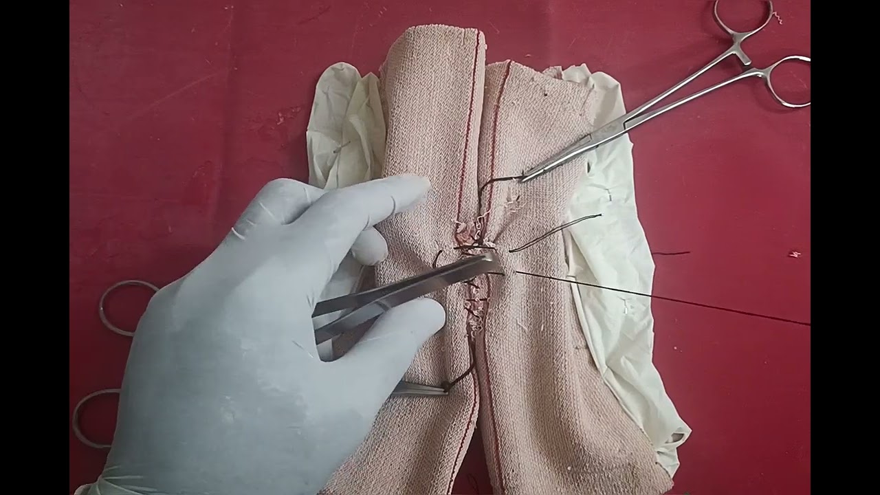 Halsted suture - bowel anastomosis 2