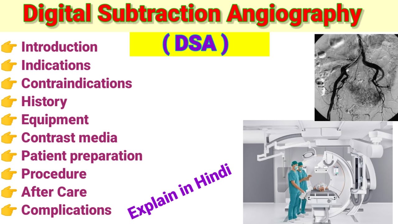 DSA ( Digital Subtraction Angiography)# DSA Procedure # Cath lab # in hindi # By BL Kumawat #