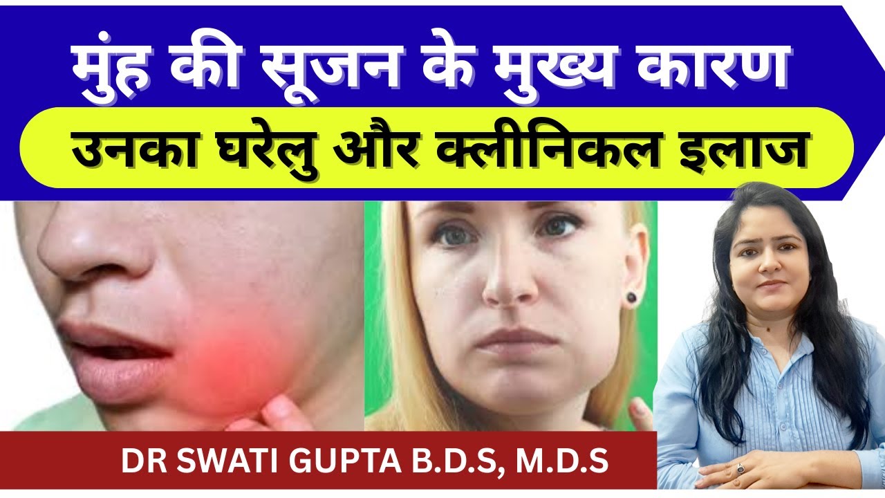 Mouth swelling reasons and treatment | do's and don'ts | muh me sujan ke upay  #dentalcare 