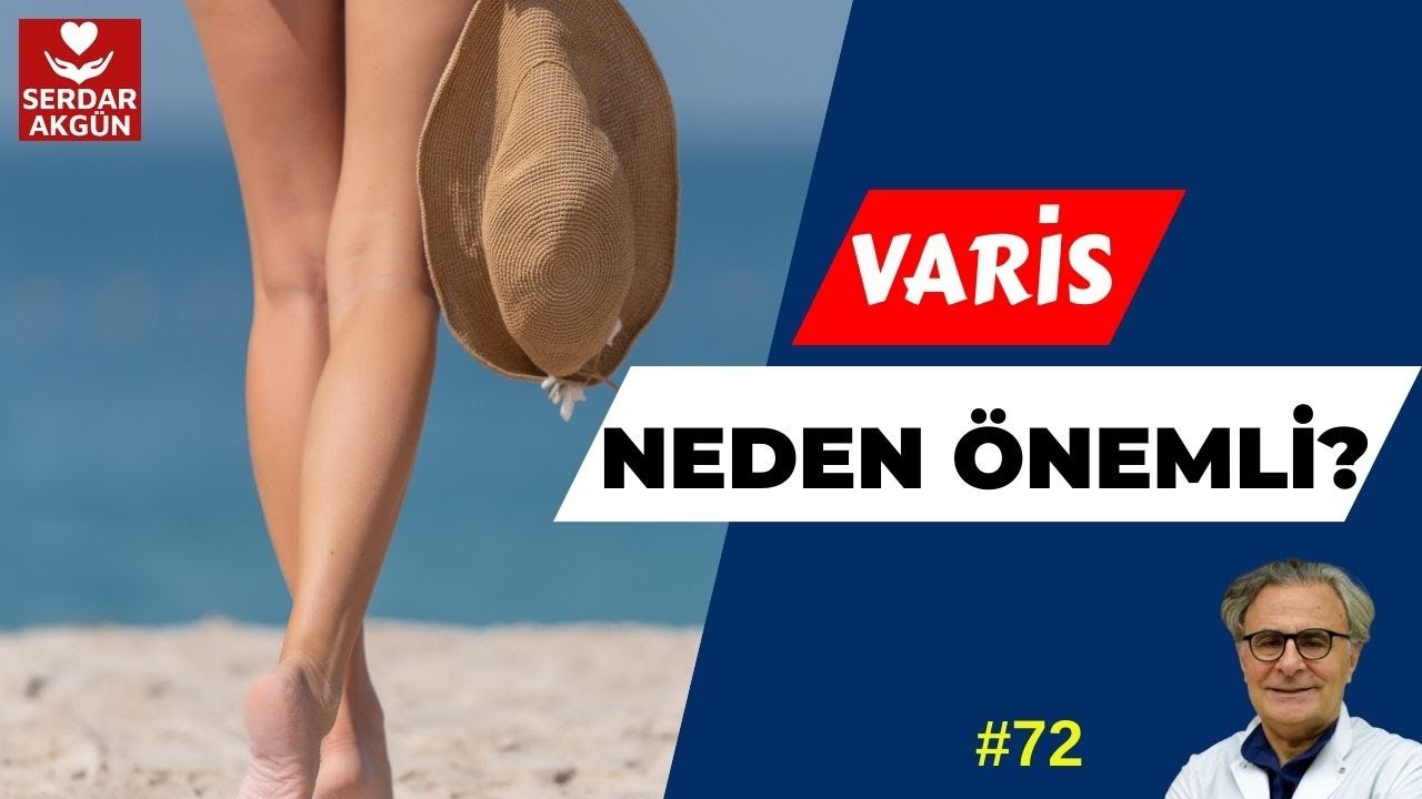 72. Varis hakkında herşey,, varis tedavisi nasıl yapılır? Prof.Dr.Serdar Akg&uuml;n, SAĞLIK
