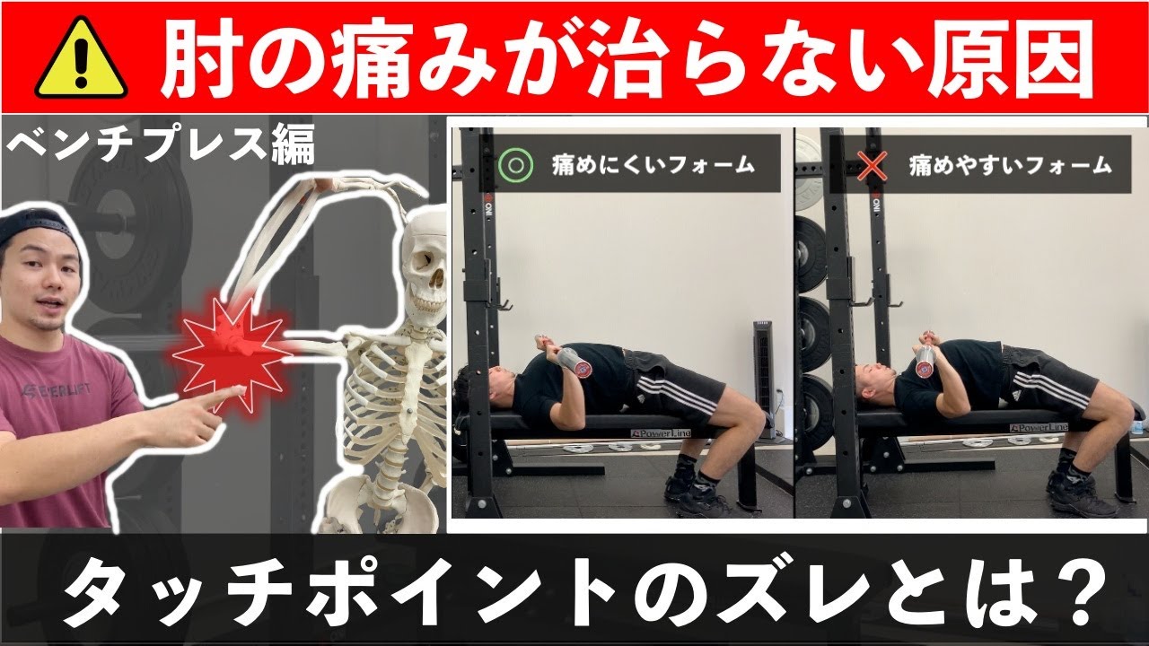【ベンチプレス】肘の痛みが治らない原因とタッチポイントのズレとは？【上腕三頭筋】