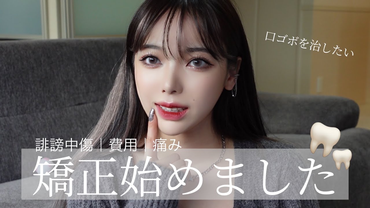 【歯列矯正を始めました🦷】上下顎前突の私。悩み続け、成人になってから治すことに決めました。病院選びのコツ｜始めた理由｜費用｜痛み｜種類など全て話しています