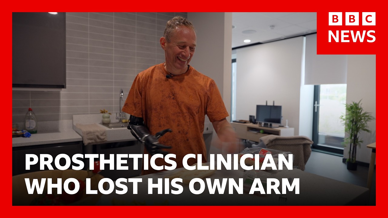 &lsquo;I worked with prosthetic limbs, then I lost my arm&rsquo; | BBC News