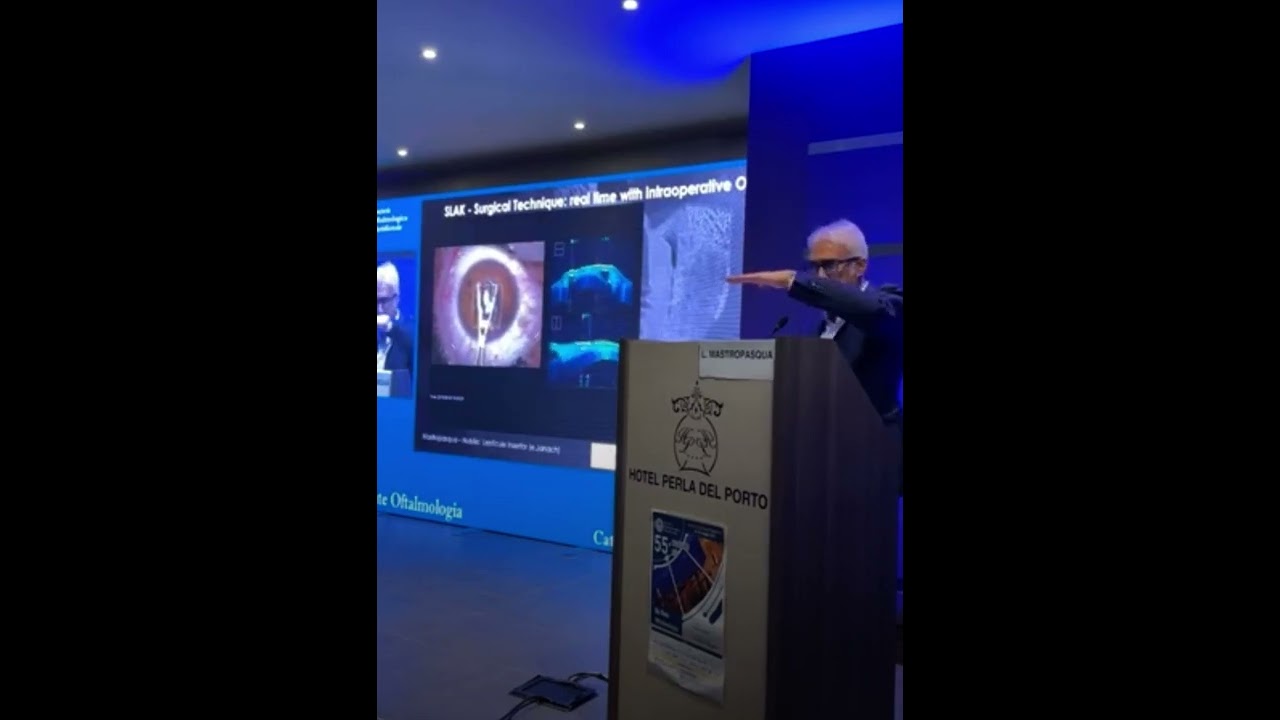 Prof. Leonardo Mastropasqua - Femtosecond laser in chirurgia corneale: dove siamo arrivati.