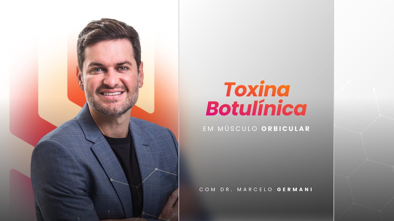 Aplicação de Toxina Botulínica em Músculo Orbicular dos Olhos