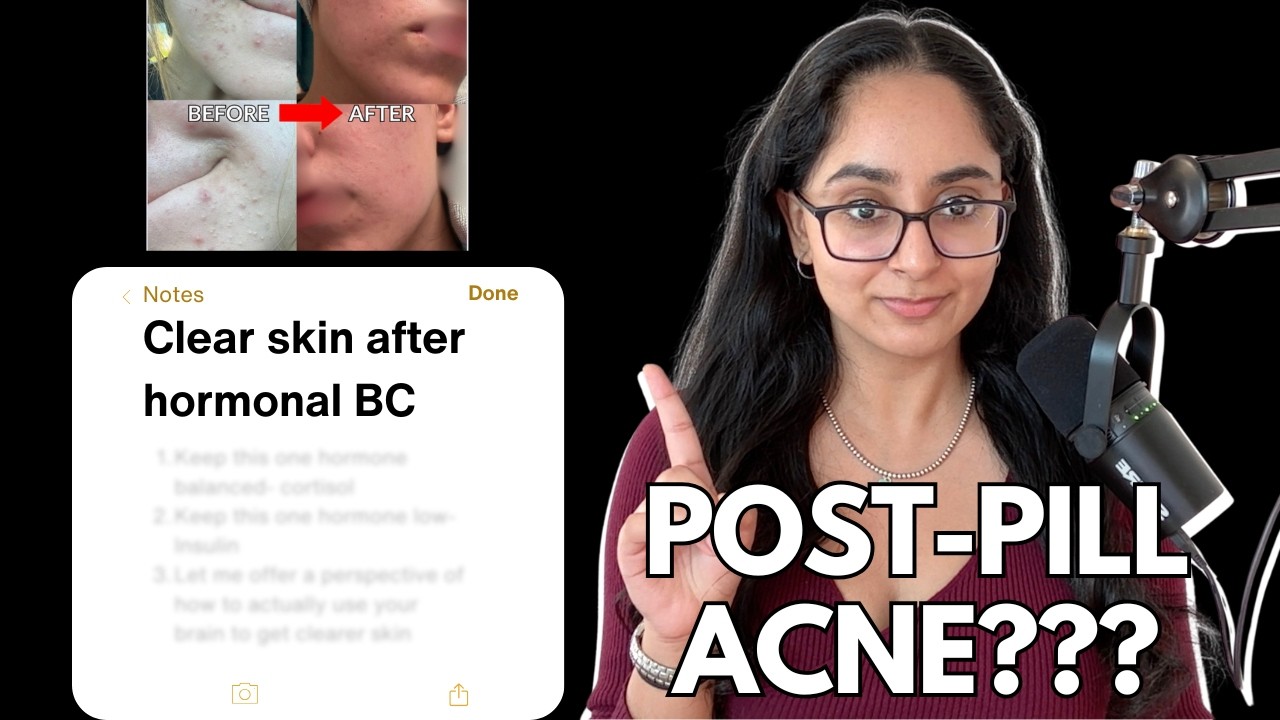 Post-Pill Acne? Don’t Panic — Do These 4 Things Instead