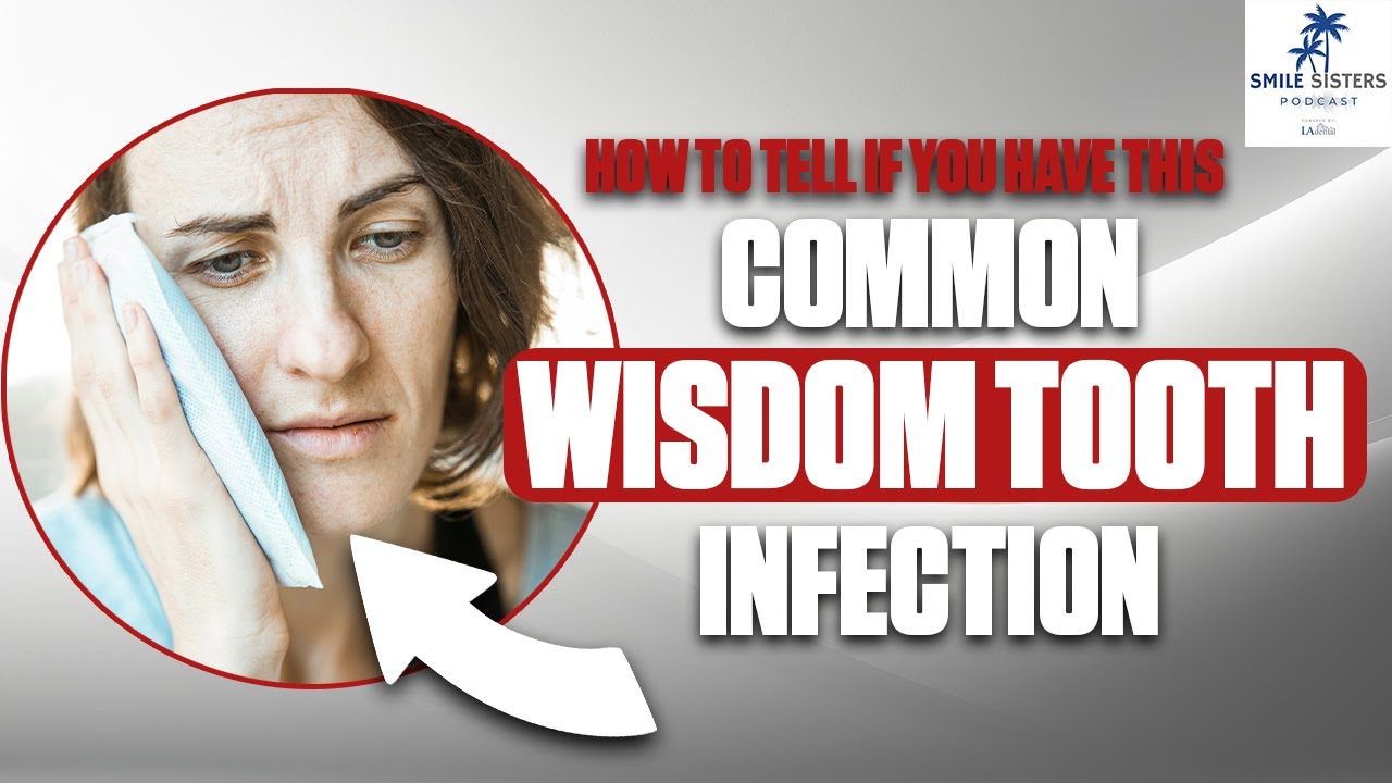 How To Tell If You Have This Common Wisdom Tooth Infection - Smile Sisters Podcast