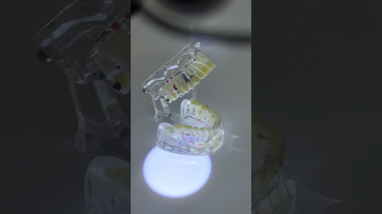 Dental Loupes Magnification for teeth surgery