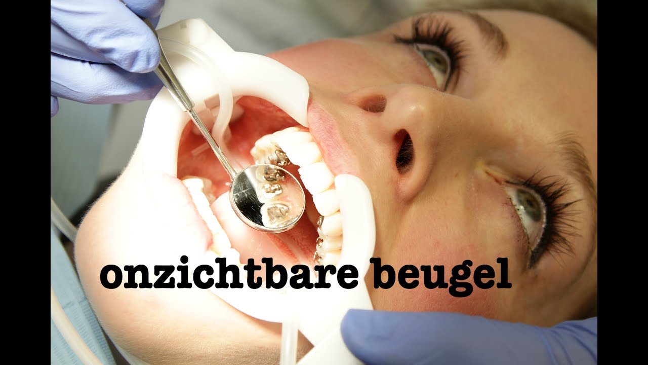 Onzichtbare beugel: Incognito Brace | FURROW.NL