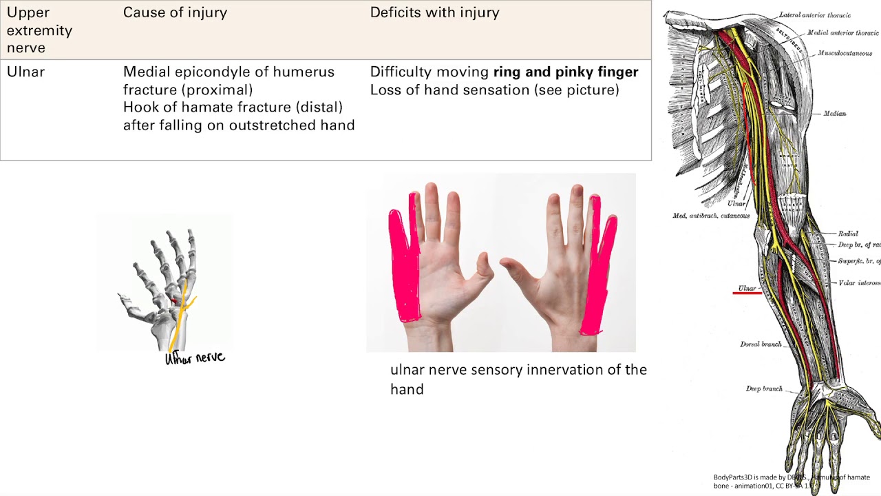 Upper Extremity Nerve Injury | MSK | Step 1 Simplified