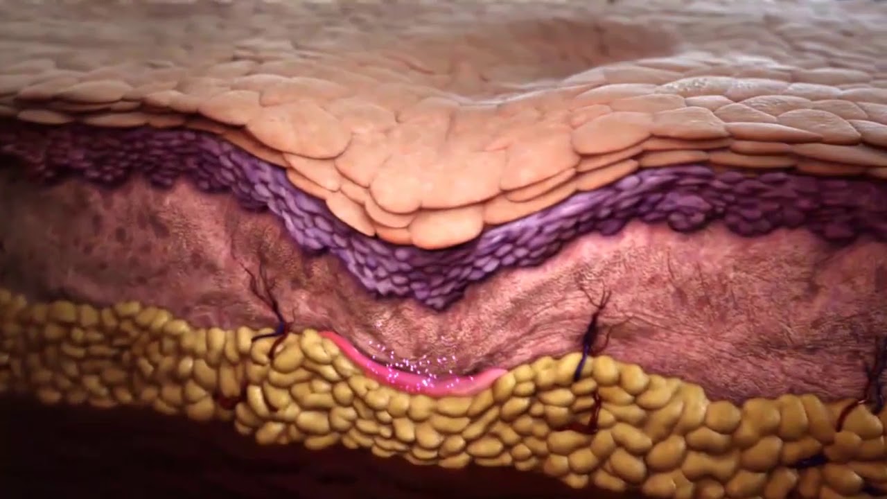 Sculptra