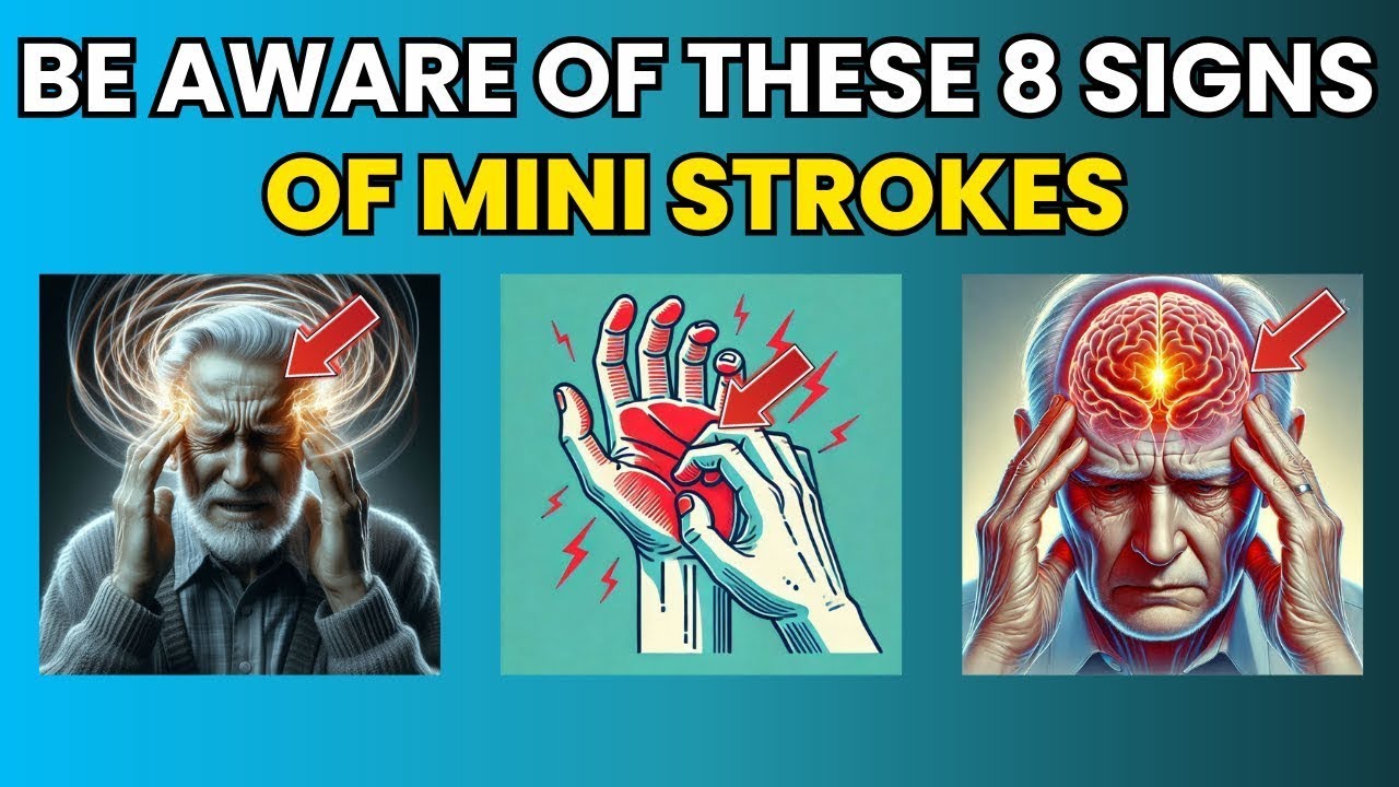 STROKE Experts Reveal 8 EARLY SIGNS That SAVE LIVES 🧠👨&zwj;⚕️