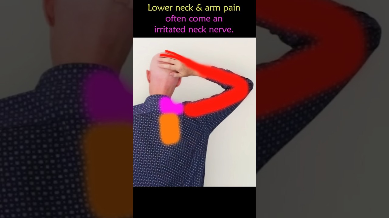 Exercise To Fix A Pinched Nerve In Neck Causing Arm Pain
