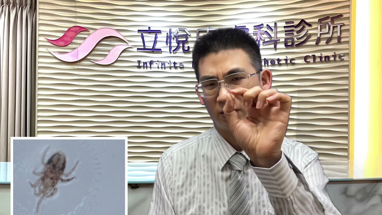 是什麼咬了我？蛛絲馬跡～