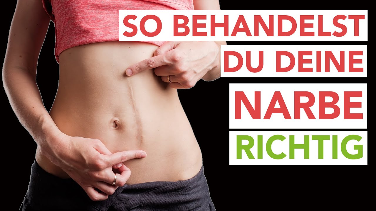 Narben Richtig Behandeln: Effektive Narbenmassage Techniken