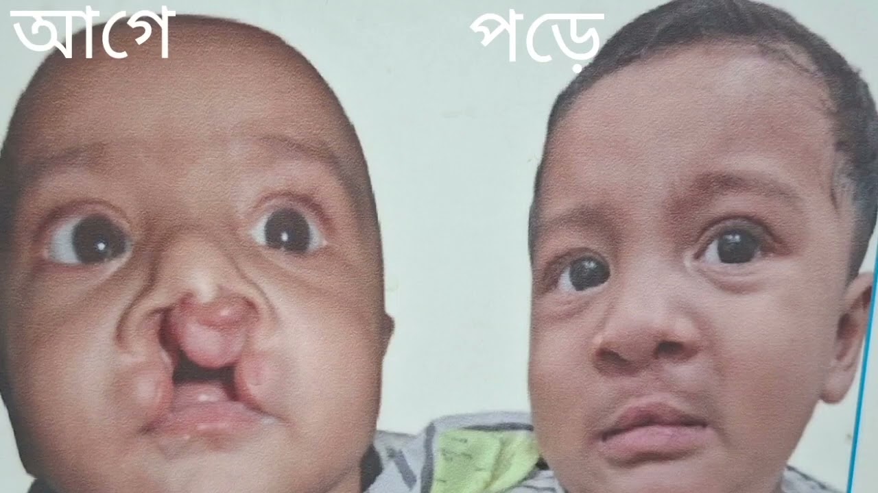 Professor Dr. BK Das (Vijay Krishna Das) is a pediatric and plastic surgery specialist. New Life Hospital.