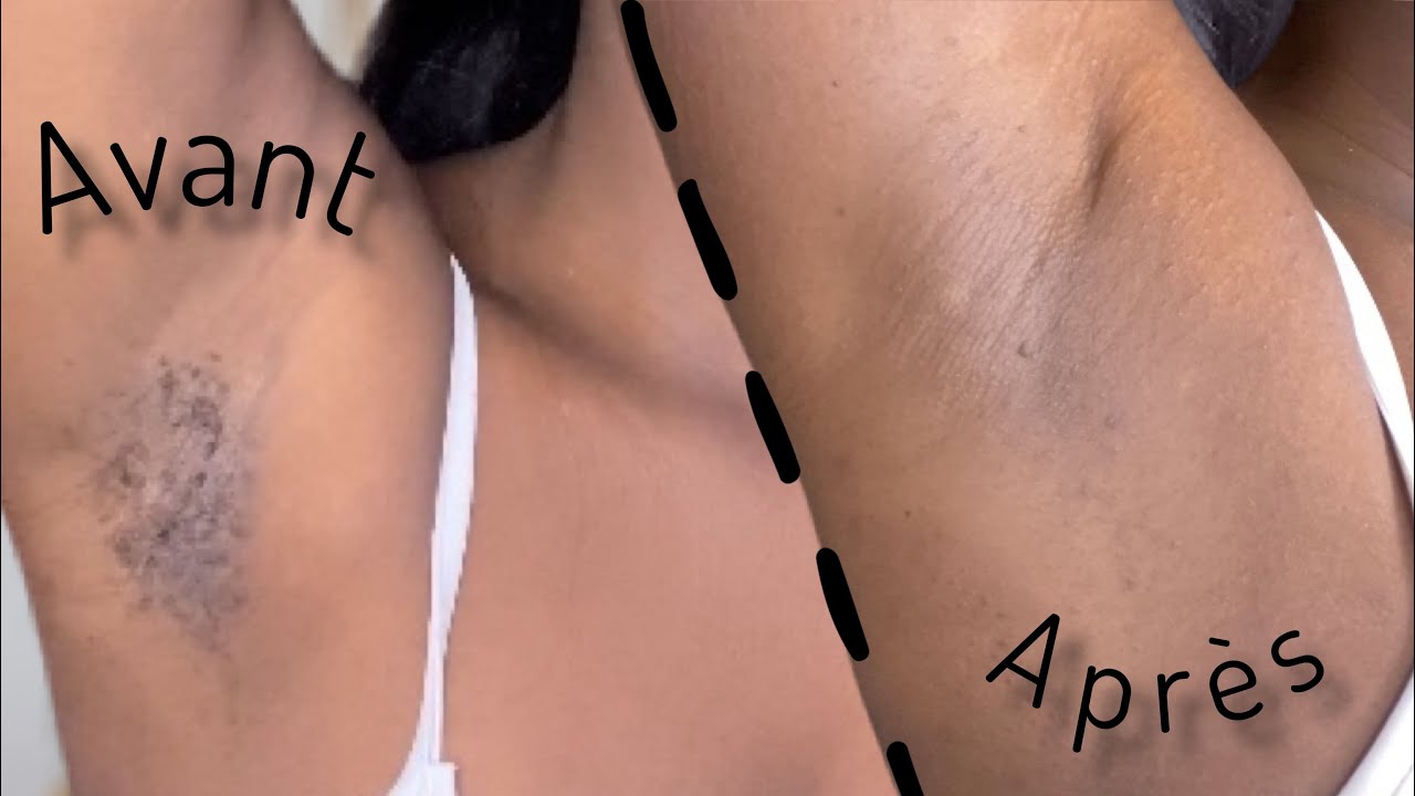 Comment s’épiler les aisselles seule avec un chauffe cire acheté sur Amazon