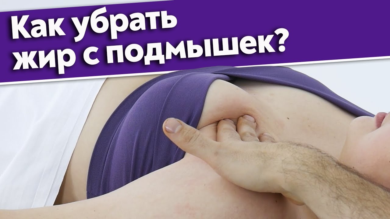 Можно ли убрать жир с передней поверхности плеча / Как убрать жир на руках?
