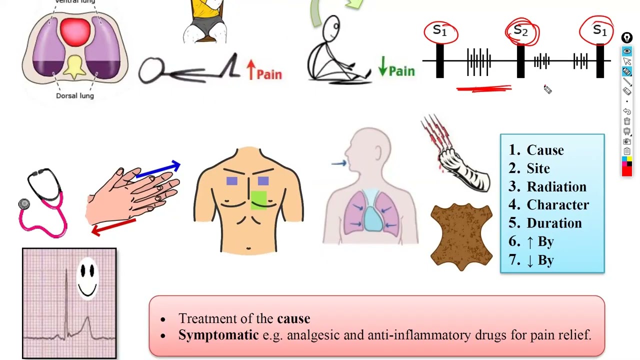 6-Pericardial & Myocardial diseases شرح باطنة دكتور سويلم