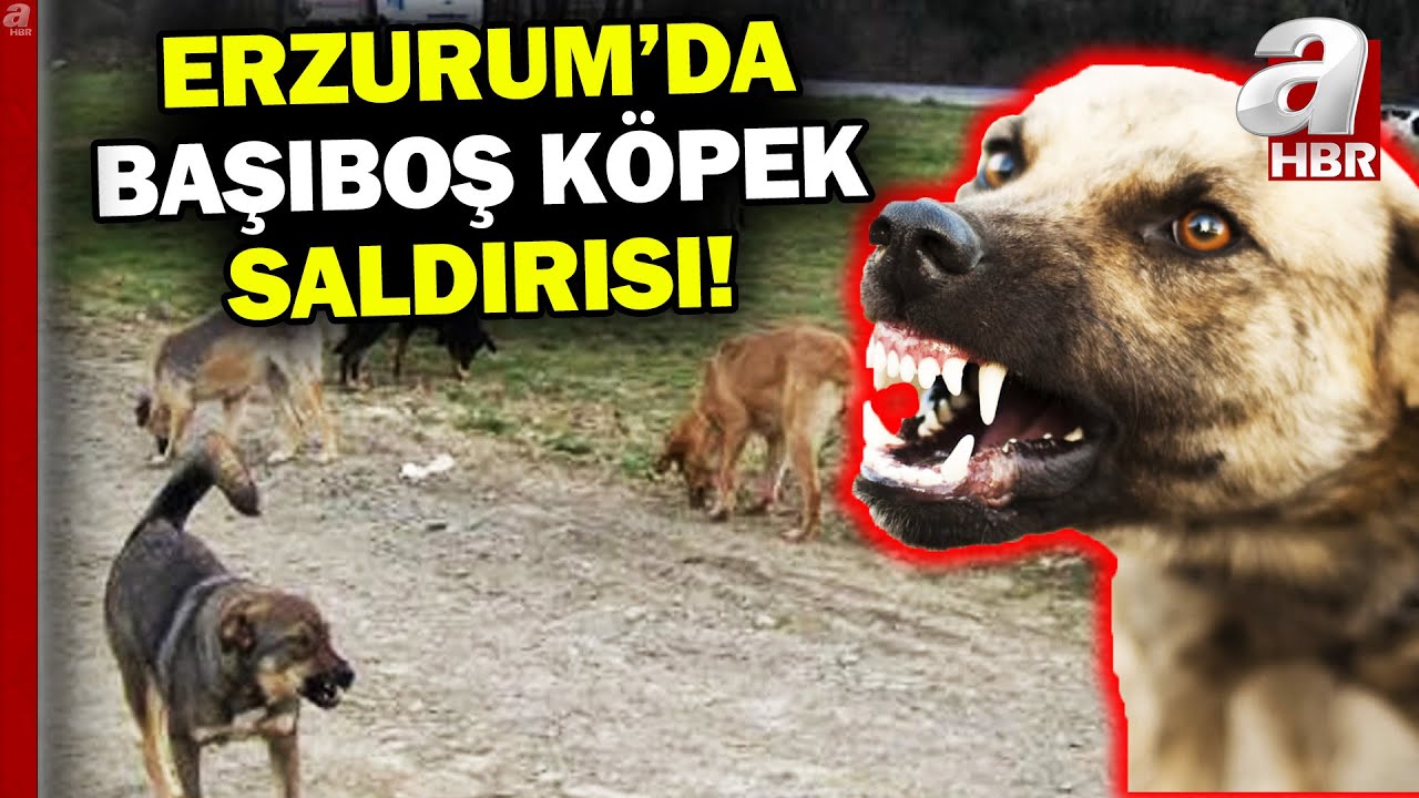 Erzurum'da başıboş köpekler çocuğu ağır yaraladı! | A Haber