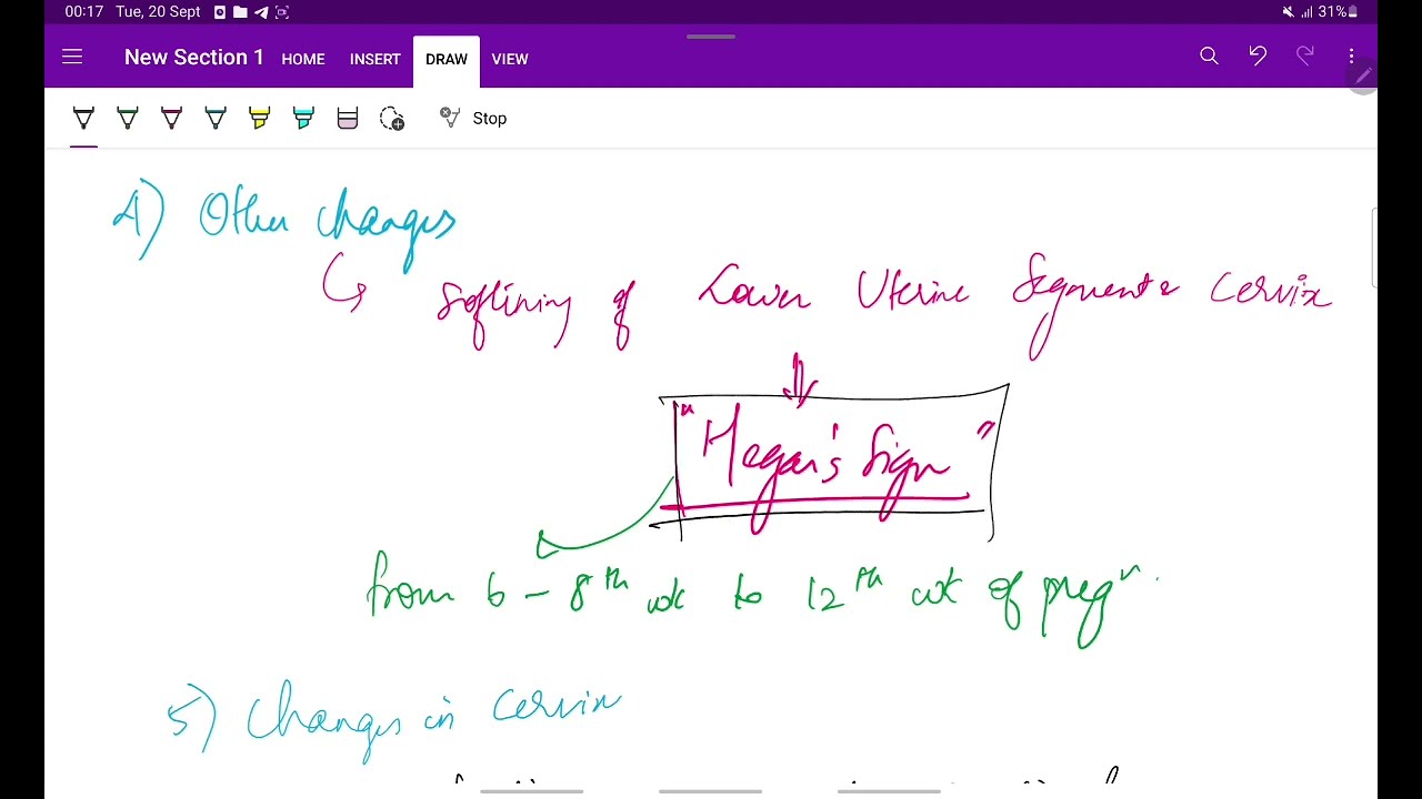 Diagnosis of pregnancy- First trimester | Symptpms | Obstetrics  | OG | Easy notes | MeDTecH29